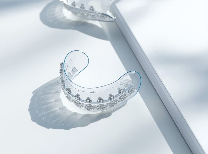 dental aligners