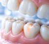 Tooth Hurts
