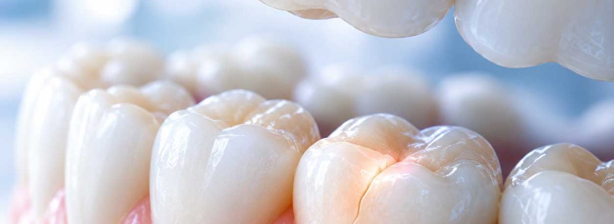 Tooth Hurts